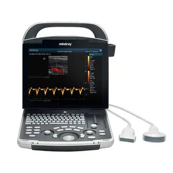 Медицинский DP-30 Популярный лучший Ч/Б ультразвуковой сканер, ультразвуковые медицинские ультразвуковые инструменты